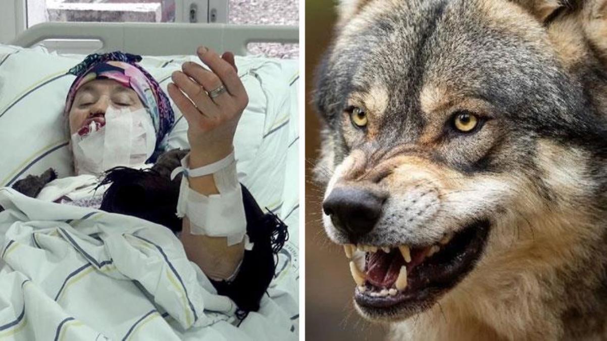 Hayvanları Beslemek İçin Ahıra Giden Kadına Kurt Saldırdı! 1'İ Ağır 4 Kişi Yaralandı