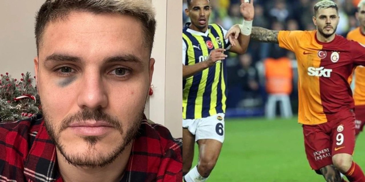 Galatasaray Taraftarına Kötü Haber: Mauro Icardi Haftalarca Maça Çıkmayacak