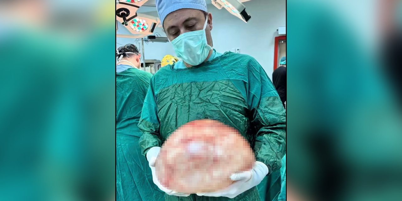 Kansızlık şikayetiyle gitti, Van’da bir kadının karnından dev kitle çıkarıldı