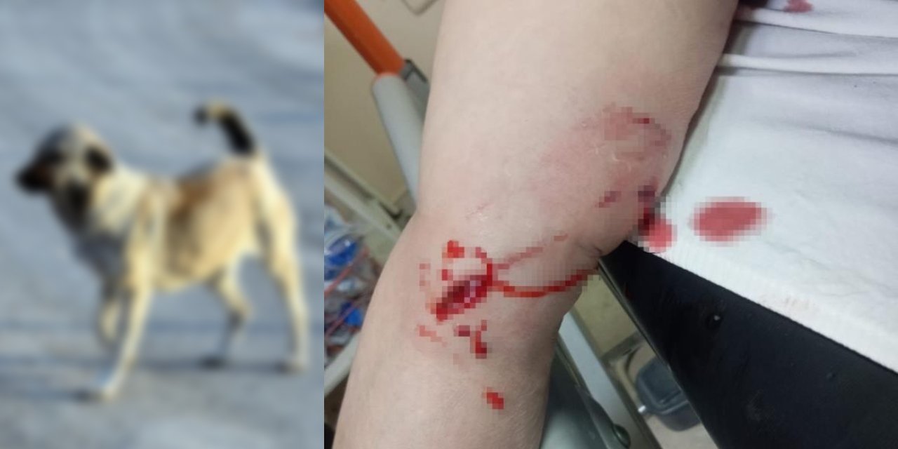 Şırnak’ta sokak köpekleri dehşet saçtı: 3 kadın yaralandı