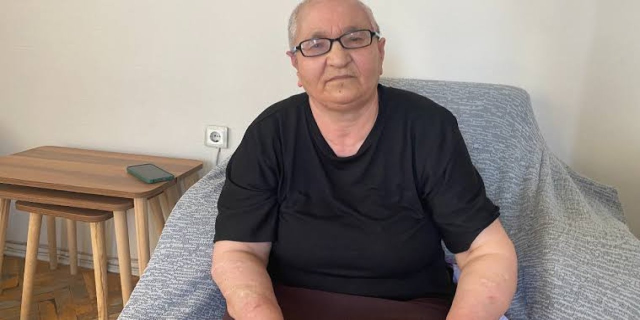Köpeklerin saldırısına uğrayan kadın 637 bin TL tazminat kazandı