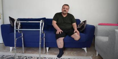 Terapi sonrası felaket: Tedavi için gitti, ayağı kesildi