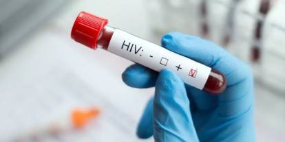 HIV tedavisinde devrim niteliğinde adım