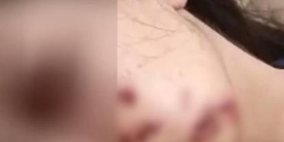 Çocukların tehlikeli maytap oyunu: Siirt’te bir genç kız yaralandı