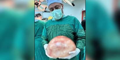 Kansızlık şikayetiyle gitti, Van’da bir kadının karnından dev kitle çıkarıldı