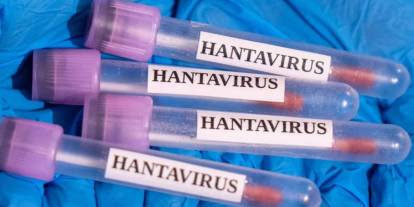 Sağlık Bakanlığı’ndan Hantavirüs açıklaması: Türkiye'de vaka var mı?