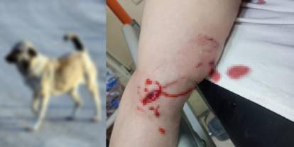 Şırnak’ta sokak köpekleri dehşet saçtı: 3 kadın yaralandı