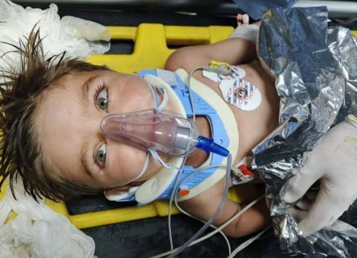 Suriye’de Kuyuya Düşen Çocuk Kurtarılarak Tedavi İçin Şanlıurfa’ya Getirildi