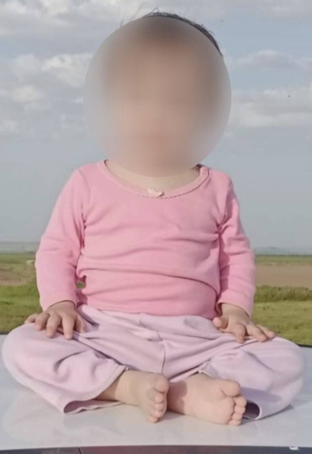 Bebeğin Down Sendromlu Doğacağını Bildirmedi, 81 Milyon Liralık Cezaya Çarptırıldı