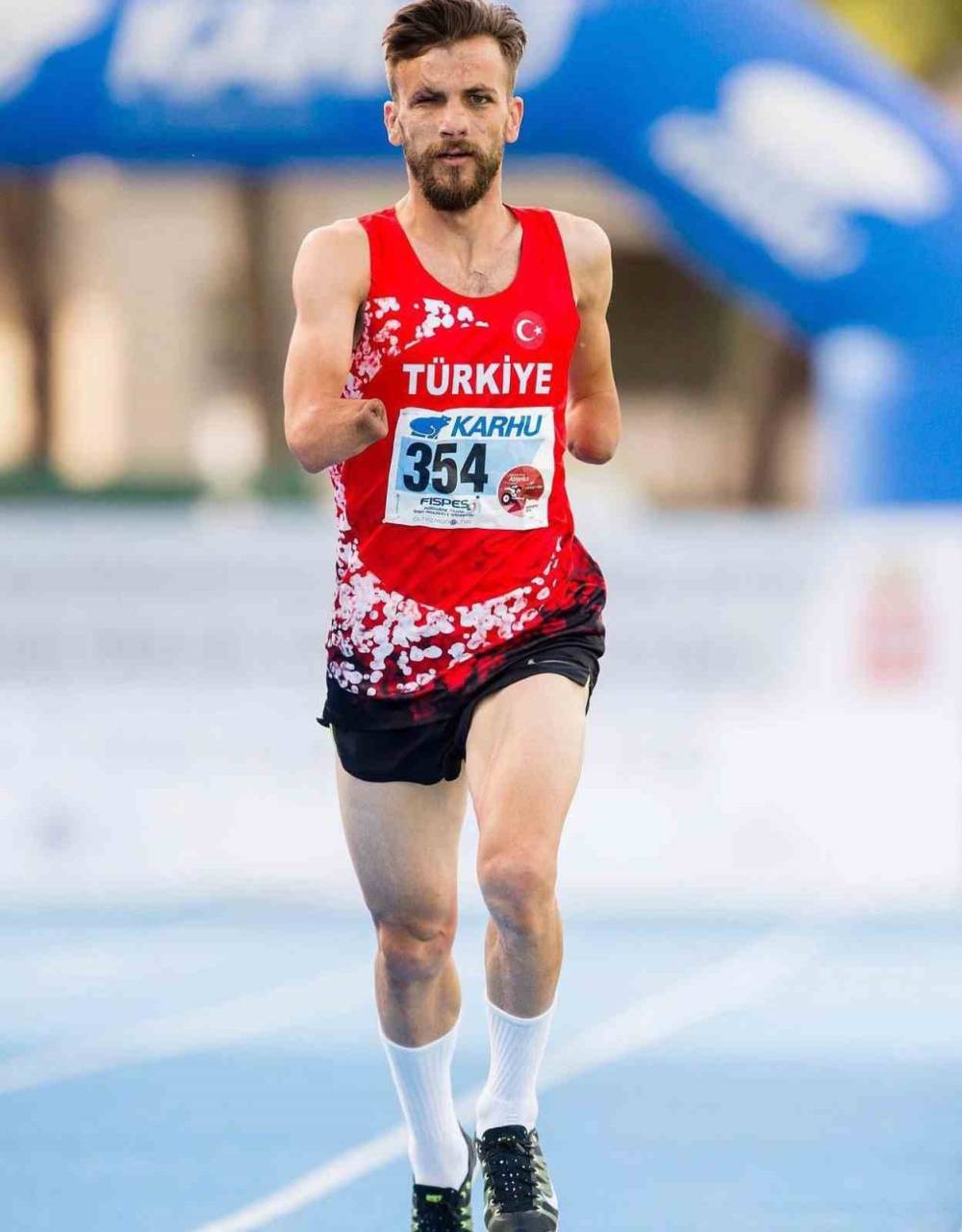 10 Yaşında İki Elini Kaybetti, Hayata Daha Çok Sarıldı